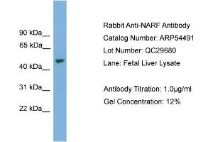 WB Suggested Anti-NARF  Antibody Titration: 0. (NARF Antikörper  (Middle Region))