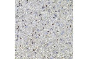 Immunohistochemistry of paraffin-embedded mouse liver using POT1 antibody (ABIN5970699) at dilution of 1/100 (40x lens). (POT1 Antikörper)