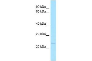 Western Blotting (WB) image for anti-Nudix (Nucleoside Diphosphate Linked Moiety X)-Type Motif 14 (NUDT14) (Middle Region) antibody (ABIN2790830)