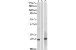 HEK293 lysate (10 µg protein in RIPA buffer) overexpressing Human HOXA1 with C-terminal MYC tag probed with AP21275PU-N (1 ug/ml) in Lane A and probed with anti-MYC Tag (1/1000) in lane C. (HOXA1 Antikörper)