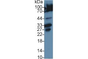 Western Blot; Sample: Human Hela cell lysate; Primary Ab: 2µg/ml Rabbit Anti-Rat CASP3 Antibody Second Ab: 0. (Caspase 3 Antikörper  (AA 29-175))