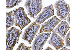 IHC analysis of Cdk2 using anti-Cdk2 antibody (ABIN7602523).