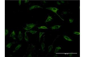 Immunofluorescence of monoclonal antibody to PKLR on HeLa cell. (PKLR Antikörper  (AA 485-574))