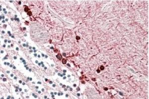 AP20186PU-N ALDH9A1 antibody staining of paraffin embedded Human Cerebellum at 3. (ALDH9A1 Antikörper  (Internal Region))