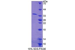 SDS-PAGE analysis of Human CES1 Protein. (CES1 Protein)