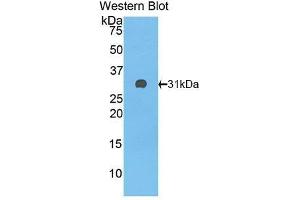 Western Blotting (WB) image for anti-Complement Factor H (CFH) (AA 915-1156) antibody (ABIN3208199) (Complement Factor H Antikörper  (AA 915-1156))