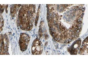 ABIN6273377 at 1/100 staining Human prostate tissue by IHC-P. (ATP12A Antikörper  (N-Term))