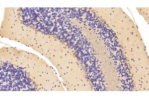 Detection of NME1 in Mouse Cerebellum Tissue using Polyclonal Antibody to Non Metastatic Cells 1, Protein NM23A Expressed In (NME1) (NME1 Antikörper  (AA 6-147))