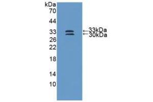 Western blot analysis of recombinant Human SOD3. (SOD3 Antikörper  (AA 19-240))