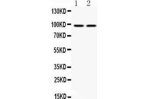 Anti- AHR Picoband antibody, Western blotting All lanes: Anti AHR  at 0. (Aryl Hydrocarbon Receptor Antikörper  (Middle Region))