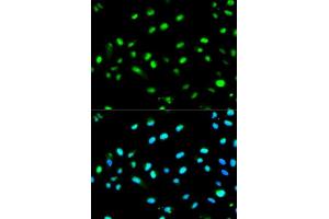 Immunofluorescence analysis of MCF7 cell using LETMD1 antibody. (LETMD1 Antikörper  (AA 161-360))