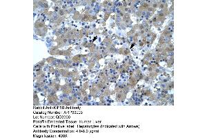 Human Liver (KIF5B Antikörper  (N-Term))