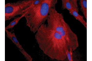 Human astrocytoma cell line CCF-STTG1 was stained with Mouse Anti-Human GFAP-CY3 and DAPI. (GFAP Antikörper  (Biotin))