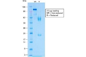 SDS-PAGE Analysis of Purified MART-1 Rabbit Recombinant Monoclonal Antibody (MLANA/1409R). (Rekombinanter MLANA Antikörper)