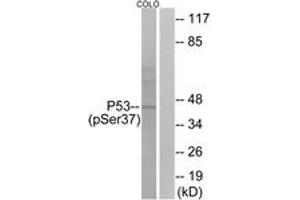 Western blot analysis of extracts from COLO cells, using p53 (Phospho-Ser37) Antibody. (p53 Antikörper  (pSer37))
