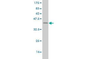 Western Blot detection against Immunogen (37. (ETV1 Antikörper  (AA 148-257))