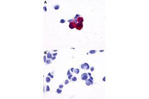 Immunocytochemistry (ICC) staining of HEK293 human embryonic kidney cells transfected (A) or untransfected (B) with PRLHR. (PRLHR Antikörper  (2nd Extracellular Domain))
