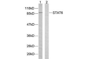 Western blot analysis of extracts from HeLa cells using STAT6 (Ab-645) antibody (E021051). (STAT6 Antikörper)