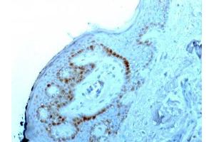 Image no. 1 for anti-Nucleolar / Nucleoli antibody (ABIN6153718) (Nucleolar / Nucleoli Antikörper)
