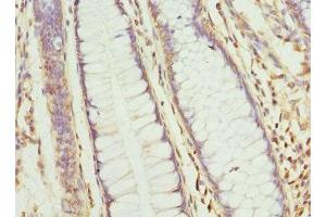 Immunohistochemistry (IHC) image for anti-Chloride Channel, Voltage-Sensitive 7 (CLCN7) (AA 626-805) antibody (ABIN7154797)