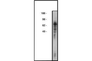 Image no. 1 for anti-Collagen, Type IV, alpha 3 (Goodpasture Antigen) Binding Protein (COL4A3BP) antibody (ABIN793680) (COL4A3BP Antikörper)