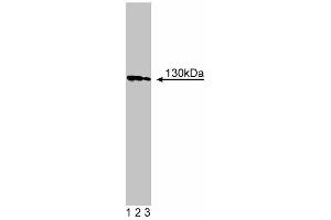 Western blot analysis of Cadherin-5 on human endothelial cell lysate.