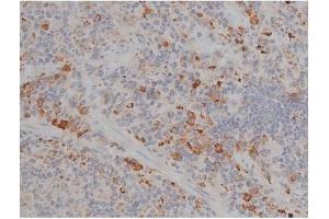 ABIN6256514 and ABIN6267359 at 1/200 staining Rat spleen tissue sections by IHC-P.
