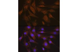 Immunofluorescence analysis of NIH-3T3 cells using LIS1 Rabbit mAb (ABIN7269401) at dilution of 1:100 (40x lens).
