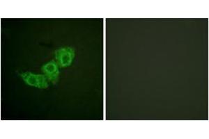 Immunofluorescence analysis of HuvEc cells, using EGFR (Phospho-Thr678) Antibody.