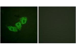Immunofluorescence analysis of HuvEc cells, using EGFR (Phospho-Thr678) Antibody. (EGFR Antikörper  (pThr678))