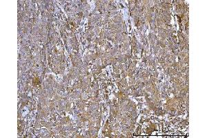 IHC analysis of CCDC115 using anti-CCDC115 antibody (ABIN7599042). (CCDC115 Antikörper  (AA 1-180))