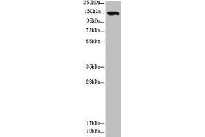 Western blot All lanes: USP28 antibody at 3.