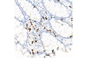 Immunohistochemistry (IHC) image for anti-CD7 (CD7) antibody (ABIN7266214)
