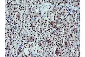 Image no. 2 for anti-Tumor Protein P73 (TP73) (AA 167-409) antibody (ABIN1491005) (Tumor Protein p73 Antikörper  (AA 167-409))