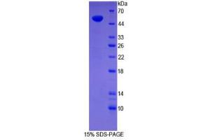 SDS-PAGE (SDS) image for Synaptopodin (SYNPO) (AA 97-300) protein (His tag,GST tag) (ABIN2123630) (SYNPO Protein (AA 97-300) (His tag,GST tag))