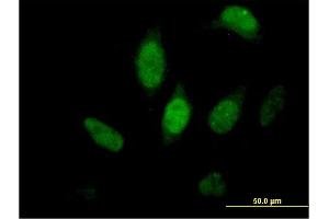 Immunofluorescence of purified MaxPab antibody to FKBP5 on HeLa cell. (FKBP5 Antikörper  (AA 1-457))
