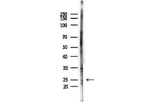 anti-SCAN Domain Containing 1 (SCAND1) (N-Term) antibody