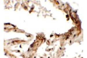 Immunohistochemistry of EMX2 in human lung tissue with EMX2 Antibody at 2. (EMX2 Antikörper  (Middle Region))