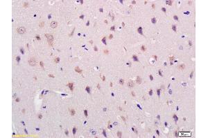 Formalin-fixed and paraffin embedded mouse brain labeled with Rabbit Anti Acylglycerol Kinase Polyclonal Antibody, Unconjugated (ABIN716741) at 1:200 followed by conjugation to the secondary antibody and DAB staining (Acylglycerol Kinase Antikörper  (AA 335-422))