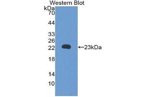 Western Blotting (WB) image for anti-Retinol Binding Protein 5, Cellular (RBP5) (AA 19-201) antibody (ABIN1860415) (Retinol Binding Protein 5 Antikörper  (AA 19-201))