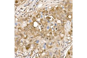Immunohistochemistry (IHC) image for anti-ATP Citrate Lyase (ACLY) (AA 752-1101) antibody (ABIN7265716)
