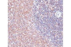 Immunohistochemistry (Paraffin-embedded Sections) (IHC (p)) image for anti-Thioredoxin-Related Transmembrane Protein 1 (TMX1) antibody (ABIN7258224)