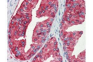 Anti-MUC13 antibody IHC of human prostate. (MUC13 Antikörper  (Internal Region))