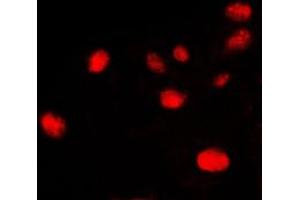 Immunofluorescent analysis of Ku70 staining in HeLa cells. (XRCC6 Antikörper  (C-Term))