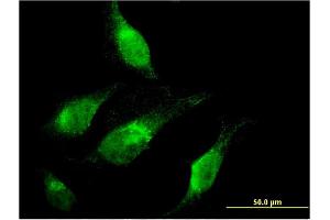 Immunofluorescence of monoclonal antibody to CHD1 on HeLa cell. (CHD1 Antikörper  (AA 1177-1272))