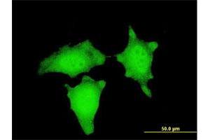Immunofluorescence of monoclonal antibody to CTNNB1 on HeLa cell. (CTNNB1 Antikörper  (AA 682-781))