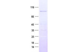 Western Blotting (WB) image for MAP/microtubule Affinity-Regulating Kinase 2 (MARK2) protein (His tag) (ABIN2725499)