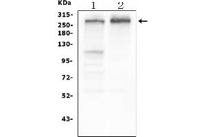 Western blot analysis of TSC2 using anti-TSC2 antibody (ABIN7600203).