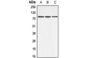 Western blot analysis of ABCB10 expression in HeLa (A), mouse kidney (B), rat kidney (C) whole cell lysates.