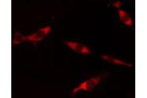 Immunofluorescence (fixed cells) (IF/ICC) image for anti-Proteasome (Prosome, Macropain) 26S Subunit, Non-ATPase, 6 (PSMD6) (N-Term) antibody (ABIN6258882)
